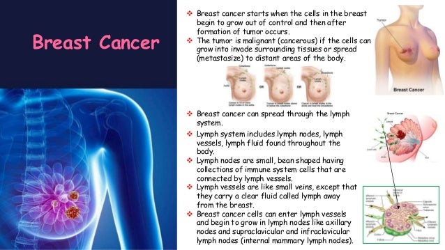 formation of breast cancer Gay lationo boys